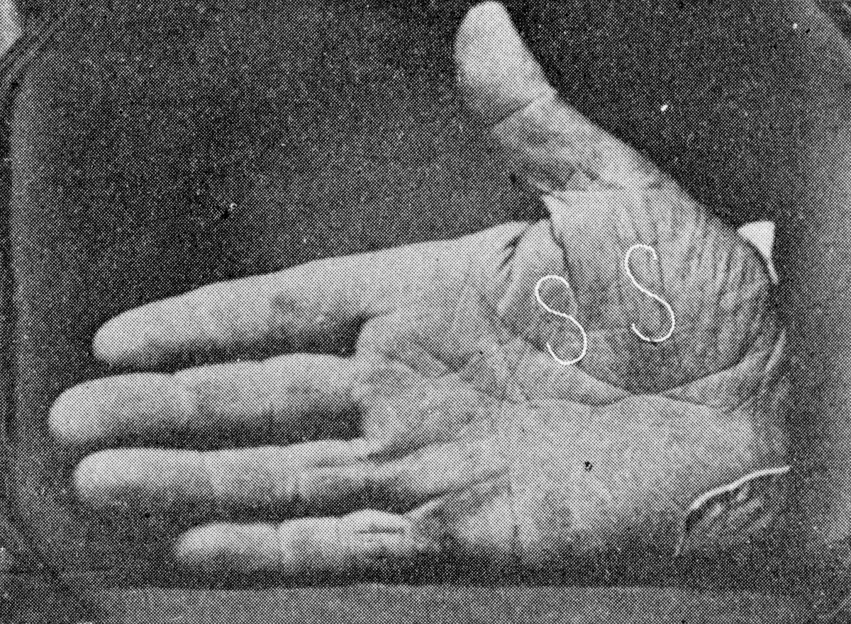 Faithful facsimile of daguerreotype taken of Captain Jonathan Walker's branded hand